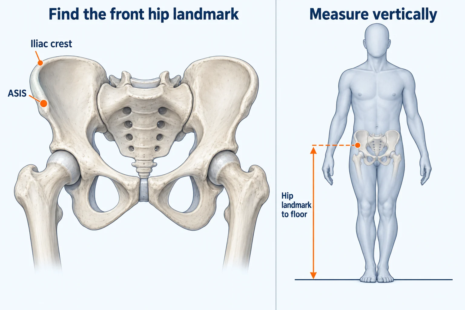 Front view of the pelvis with the ASIS marked below the upper iliac crest, beside a standing figure showing a vertical measurement from the same hip landmark to the floor.